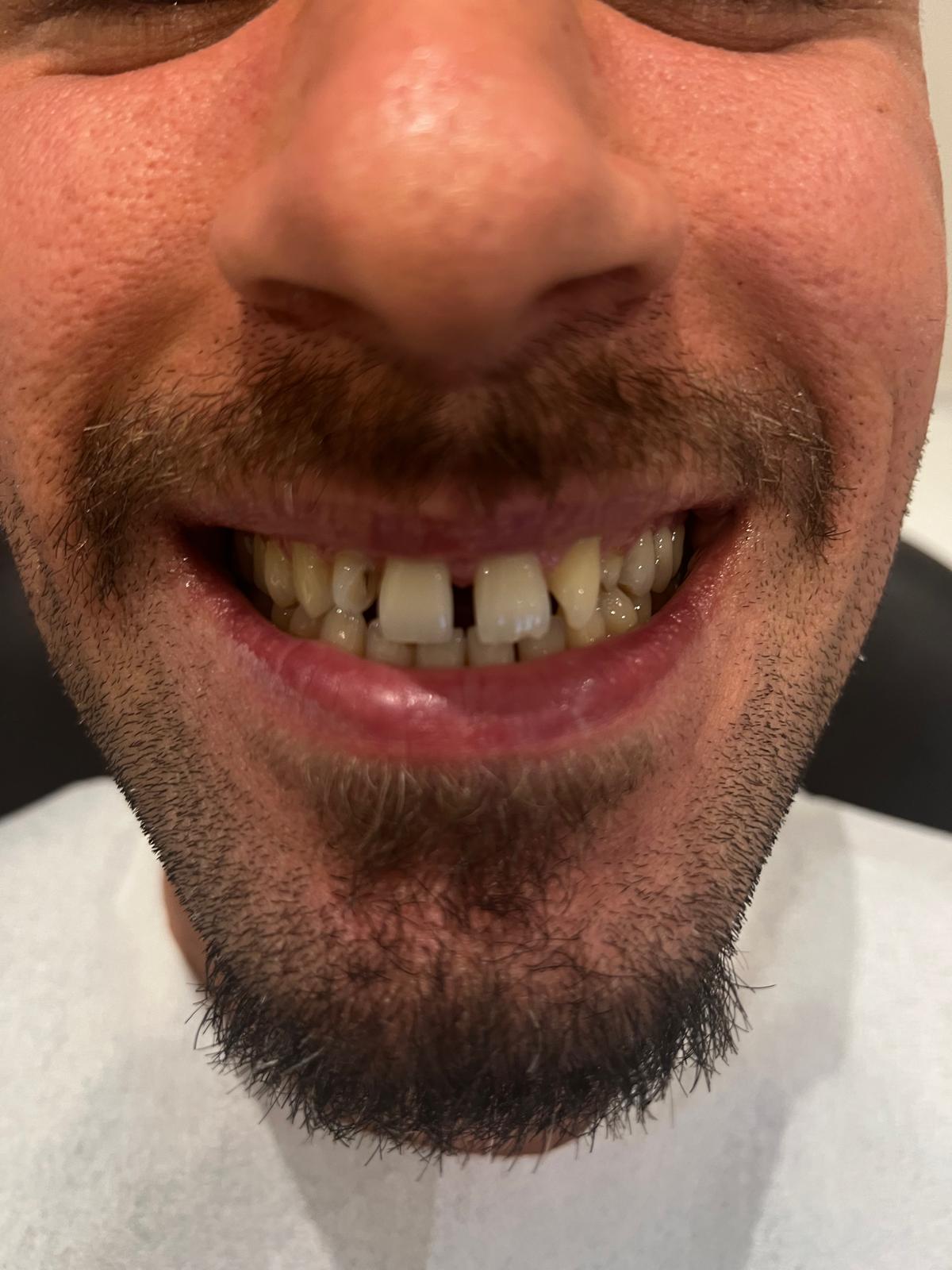 ECE Dental Patient Transformation